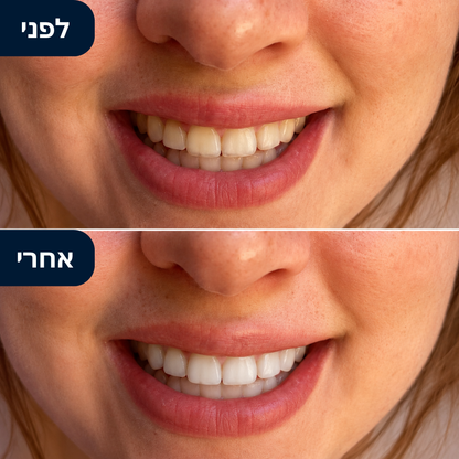 מארז הלבנה PAP+ - להלבנה והגנה